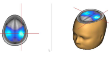 Brain Rhythms and Action
